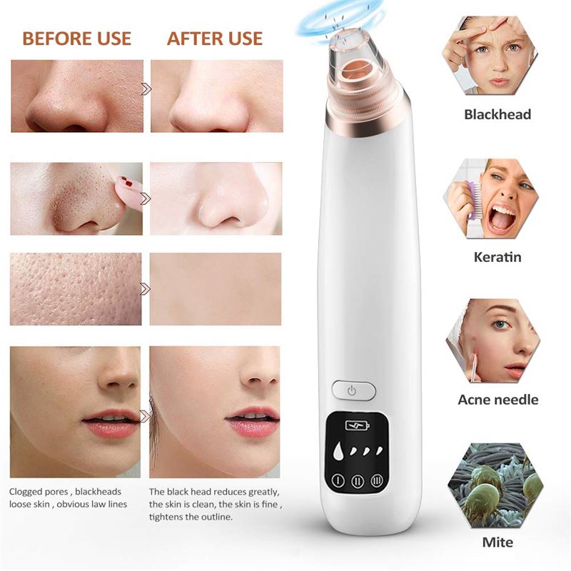 Mr Blackhead Remover Suction – Mitesserentferner / Mitesserabsauger – Mitesser