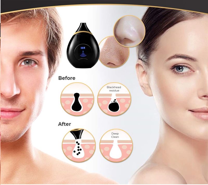 Oval Pro Vaccum Blackhead Suction - Effective Blackhead Suction - | Fashiongirl