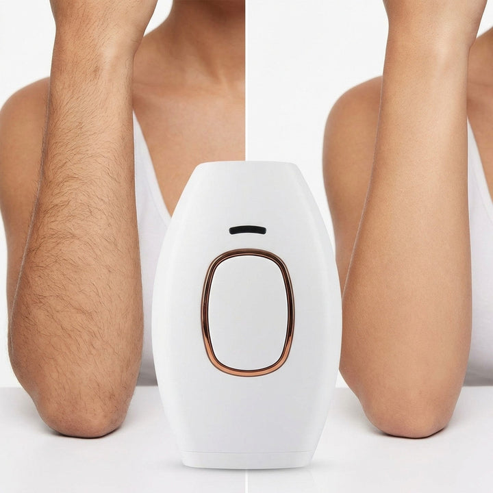 UNIQ IPL Hair Removal Device - Smooth, Pain - Free Permanent Hair Reduction at Home, 600,000 Flashes - Hair removal - UNIQ